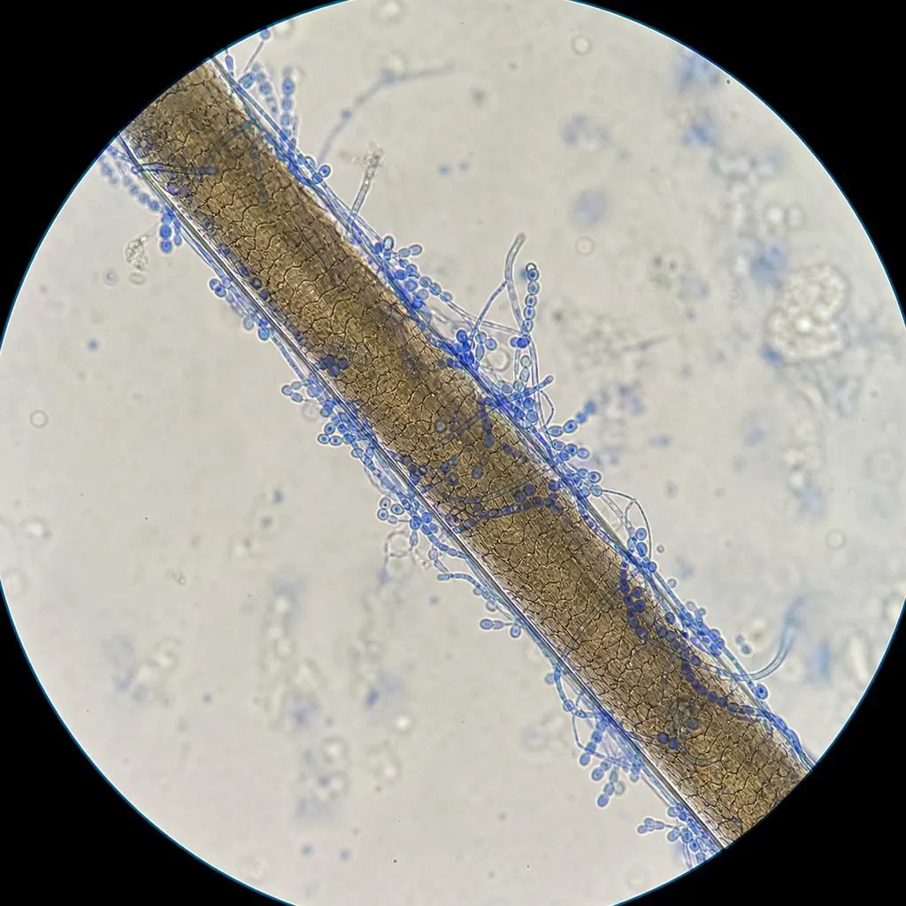 Examen microscopique montrant des spores fongiques autour d'une tige capillaire